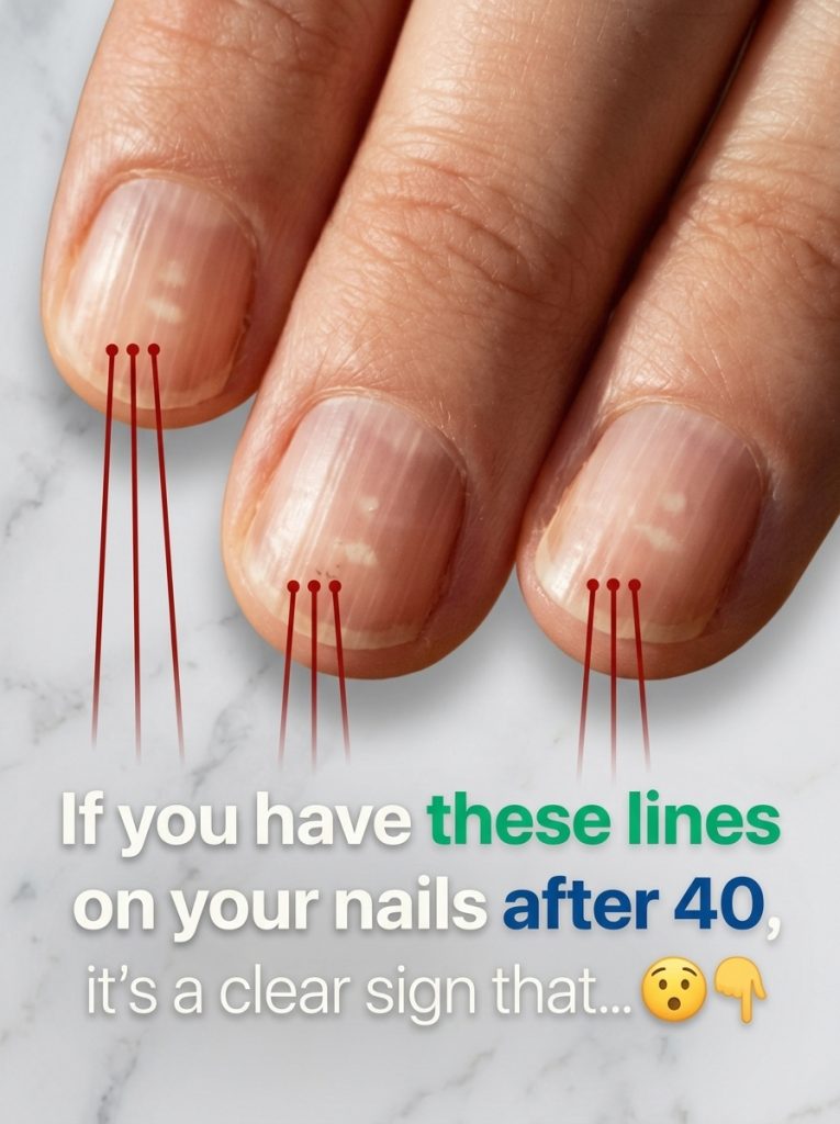 Foods That Support Stronger Nails After 40